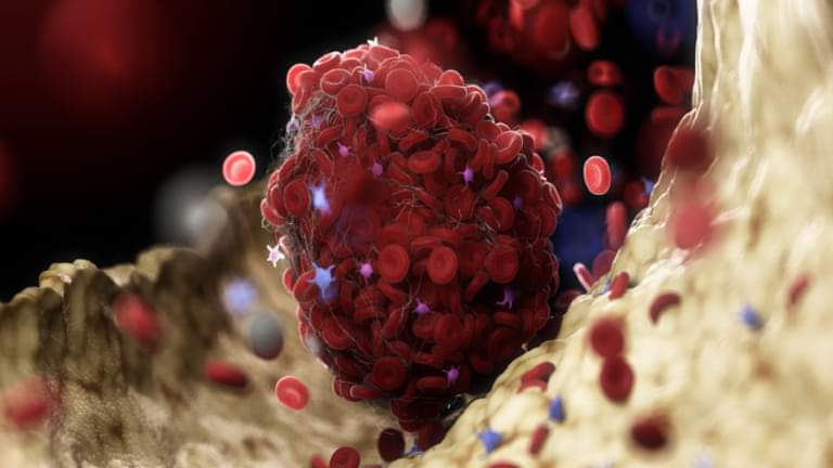 خبيرة توصي بمكملات غذائية “قوية” لمنع تجلط الدم مع بلوغنا منتصف العمر! خبيرة توصي بمكملات غذائية “قوية” لمنع تجلط الدم مع بلوغنا منتصف العمر!